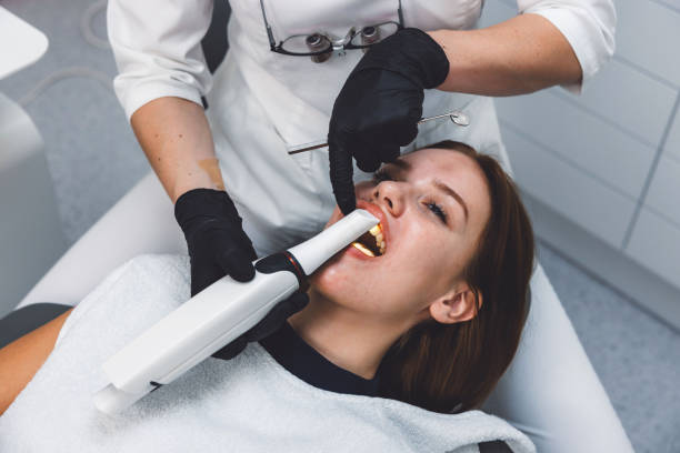 Best Emergency Wisdom Teeth Removal in Channel Lake, IL